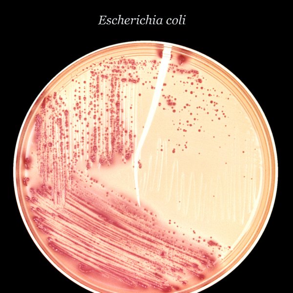 Кишечная палочка Escherichia coli