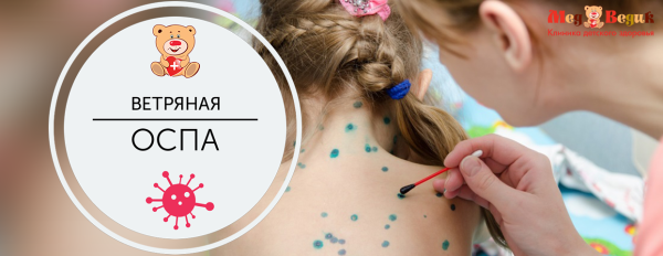 Клиника при ветряной оспе