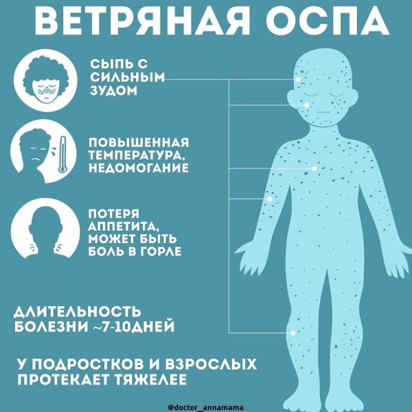 Вирусная инфекция ветрянка