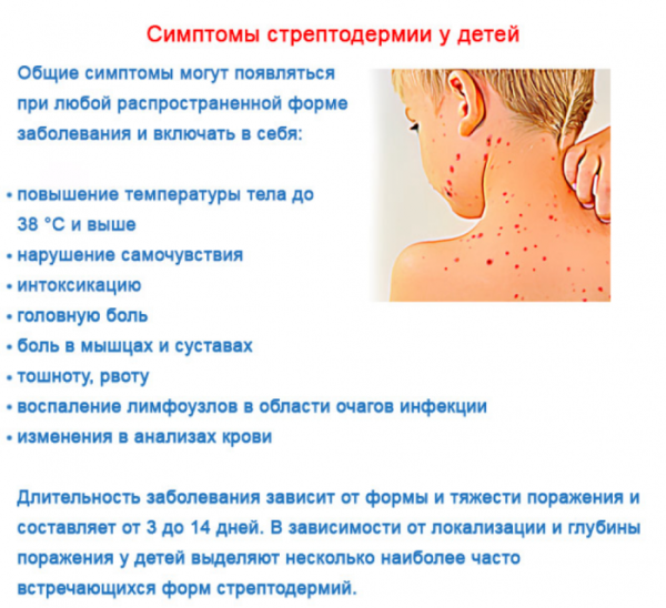 Ветрянка инкубационный период