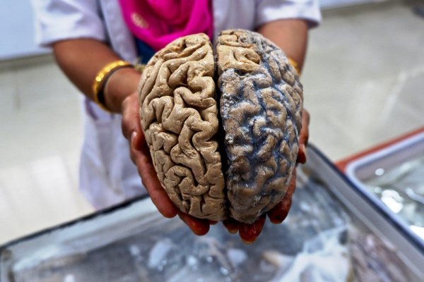 Мозг человеческий картинки (49 фото)