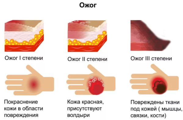 Жечь