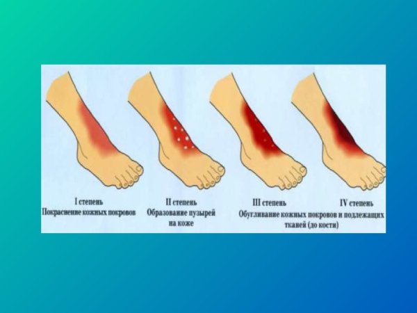 Химические и термические ожоги презентация