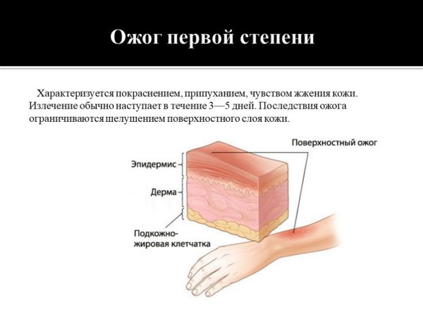 Химический ожог кожи рук