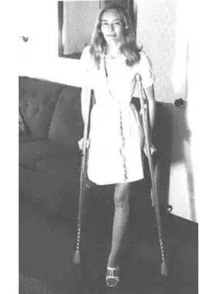 Женщины ампути из СССР