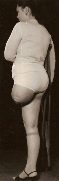 Ампути ретро СССР на протезах