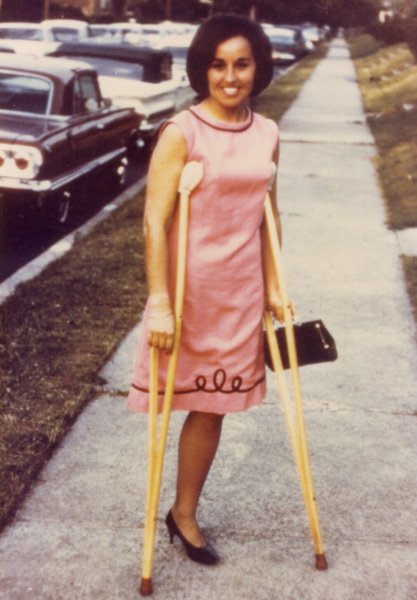 Аделаида Бестужева в ампути