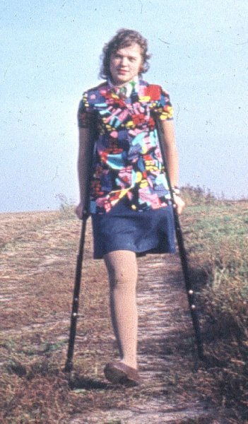 Валери Хиршфилд ампути