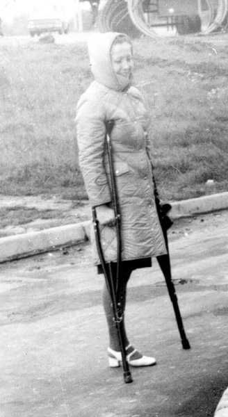 Анна Евстигнеева ампути