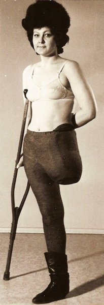 Новотны Мэри ампути ретро