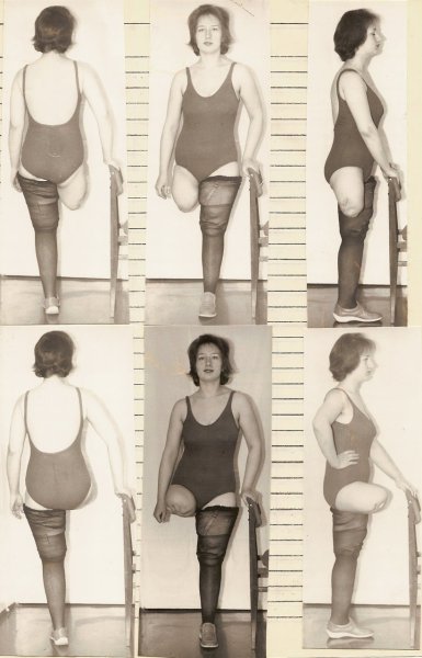 Ампути женщины в изобразительном искусстве