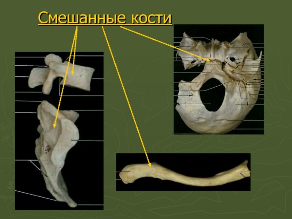 Смешанные кости