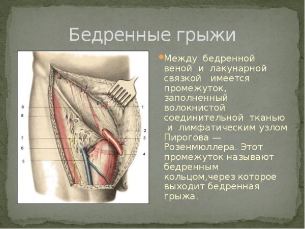 Бедренный треугольник бедренные грыжи