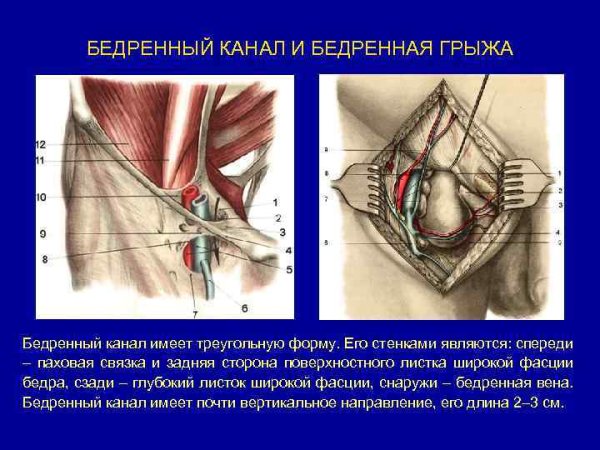 Бедренные грыжи топографическая анатомия