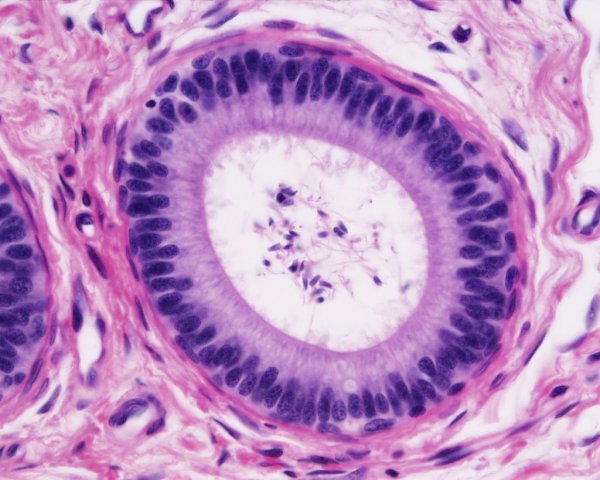 Гистология яичко картинки (49 фото)