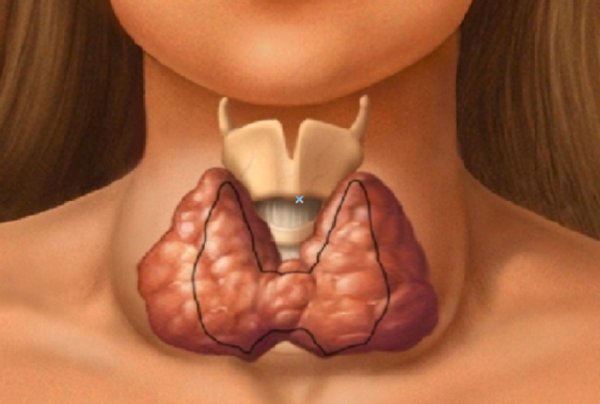 Картинки щитовидка (48 фото)