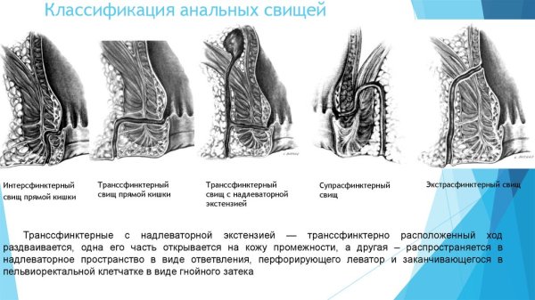 Отросток на анальном отверстии