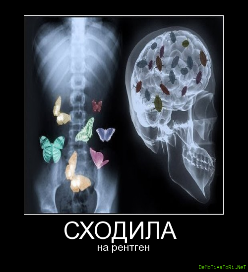 Рентген прикол