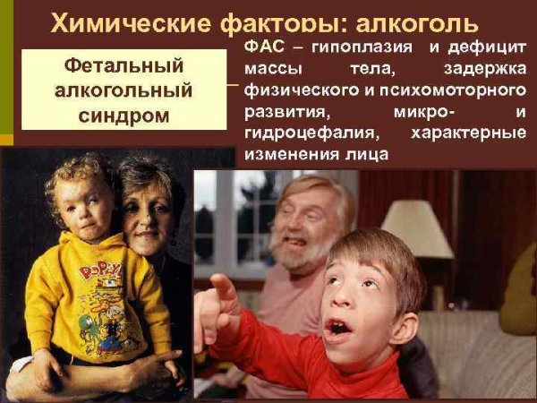 При фетальном алкогольном синдроме выявляются следующие нарушения