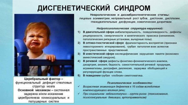 Дисгенетический синдром