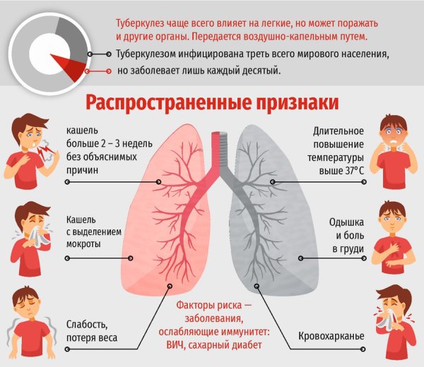 Начальные симптомы туберкулеза