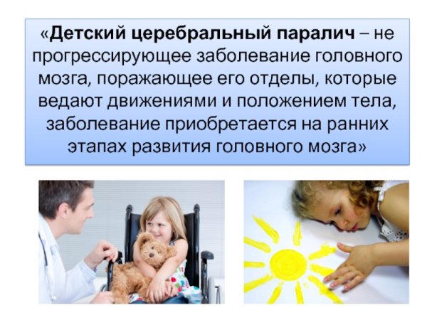 Прогрессирующее ДЦП