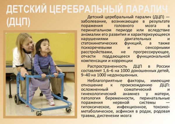 Характеристика заболевания ДЦП