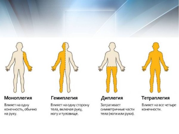 Гемипарез парапарез параплегия и гемиплегия
