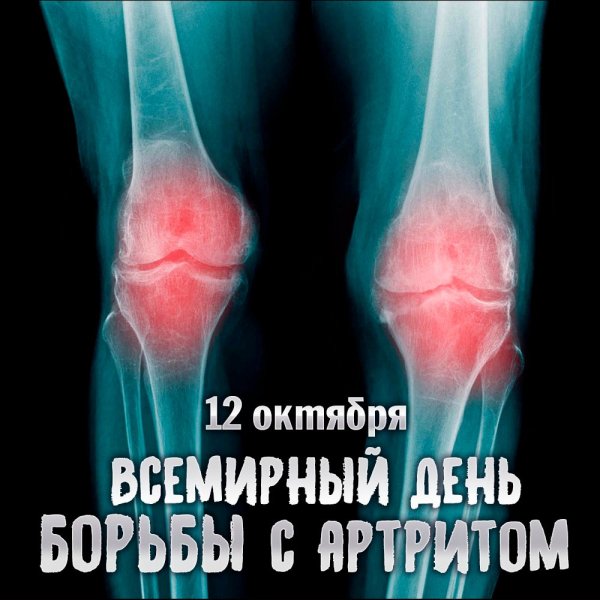 Картинки на Всемирный день борьбы с артритом (46 фото)