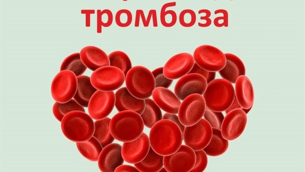 Всемирный день борьбы с тромбозом