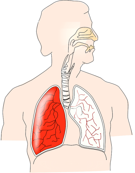 Поражение органов дыхания