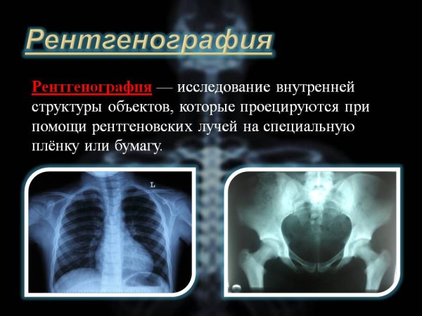 Рентгеноскопия и рентгенографи