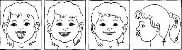 Артикуляционная гимнастика для детей черно белая